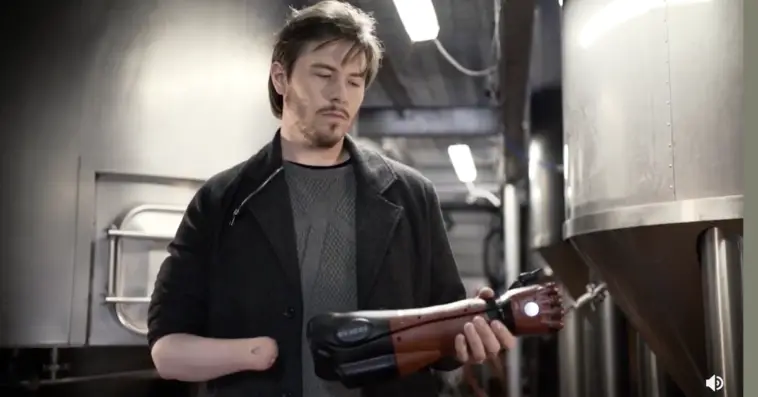 bionic metal gear arm