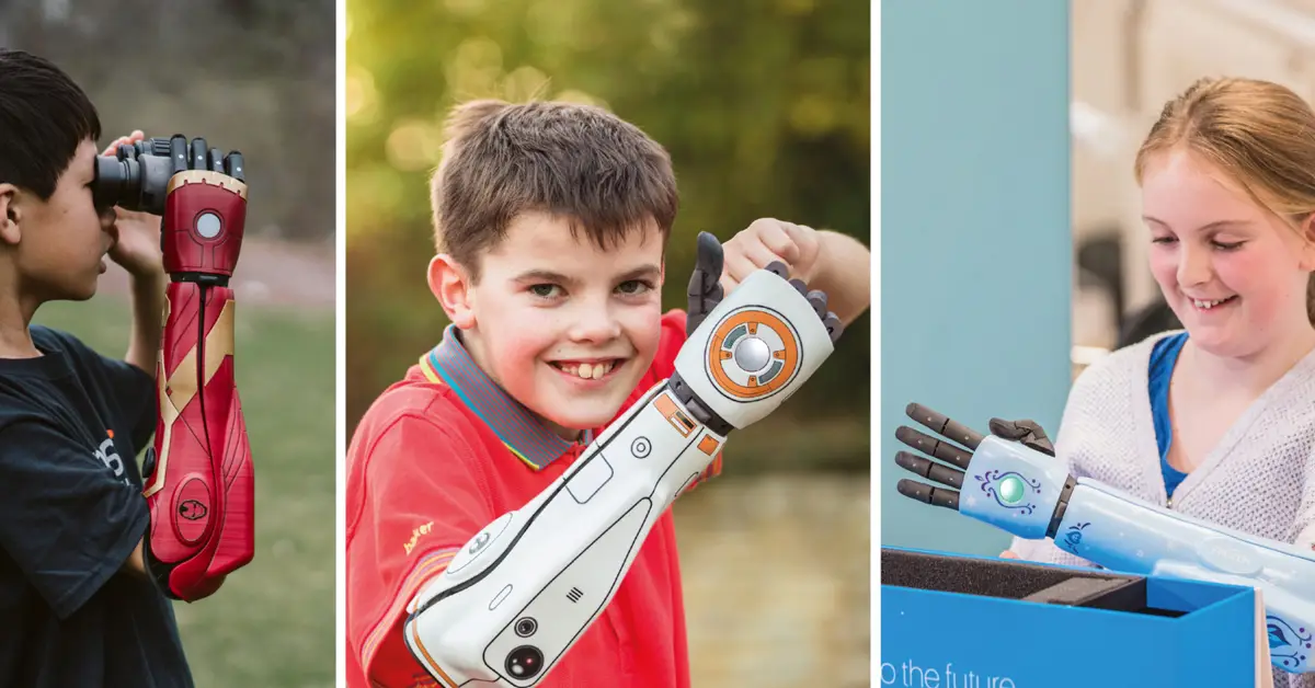 bionic arms